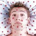 Кір не відступає — зробіть щеплення дитині до початку навчального року