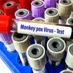 Що варто знати про вірус мавпячої віспи?