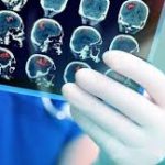 Безоплатні медичні послуги у випадку інсульту під час війни